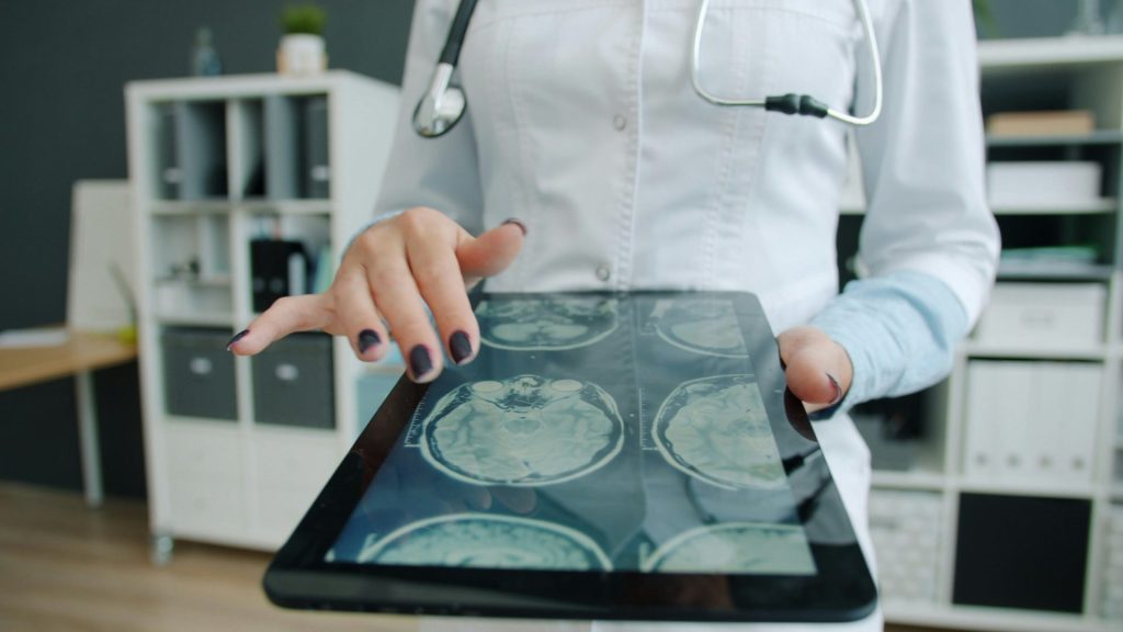 Arzt zeigt Gehirnscan auf einem Tablet in der Praxis